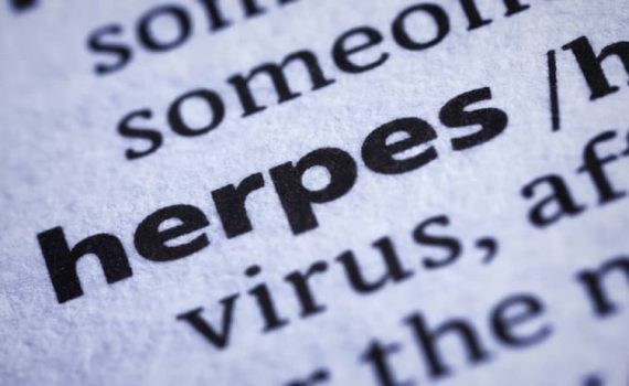 Herpes Prevention - Proven Stress Relief Methods
